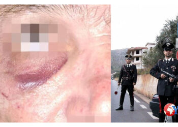 È accaduto a Belmonte Mezzagno in provincia di Palermo, un anziano vistosi tirare addosso degli oggetti aveva rimproverato il minore