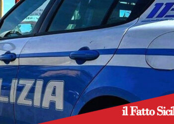 Catania. Sfregia il volto di un poliziotto. Arrestato