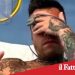 Fedez dimesso dall’Humanitas: è tornato a casa