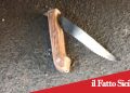 Aci Bonaccorsi. Accoltellamento all’esterno di un bar. Arrestato per tentato omicidio